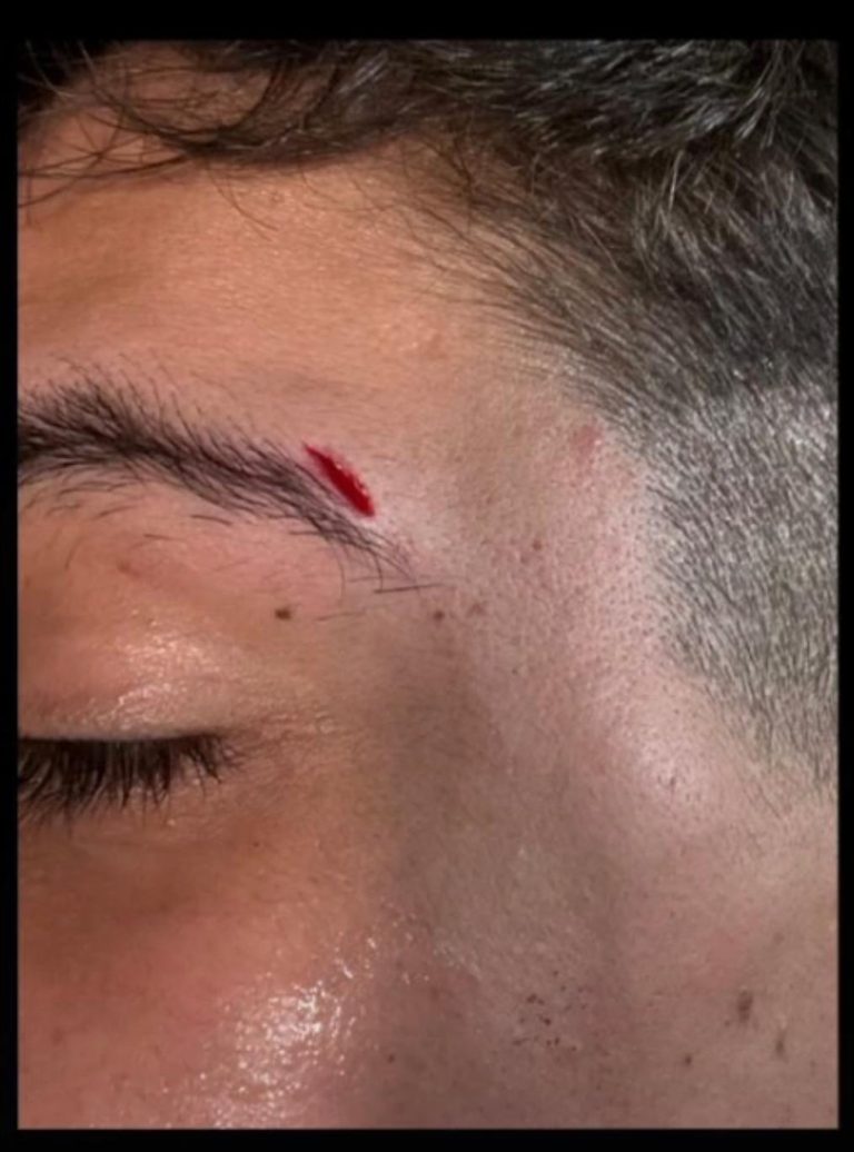 O Consello do Estudantado da USC condena a agresión homófoba en Santiago e reclama unha resposta colectiva fronte ao odio